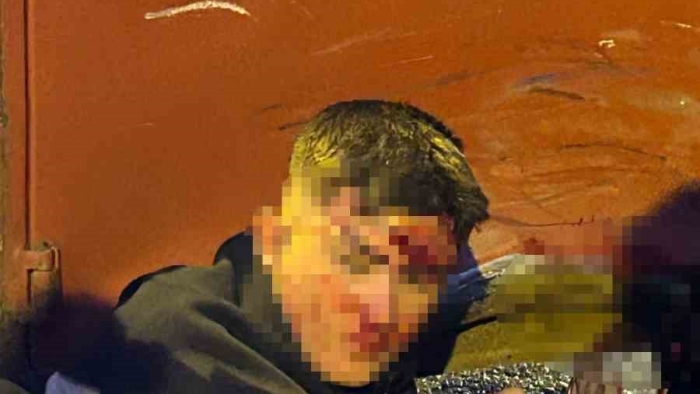 Kocaeli’de 2 motosiklet ve kamyonetin karıştığı kazada 4 kişi yaralandı